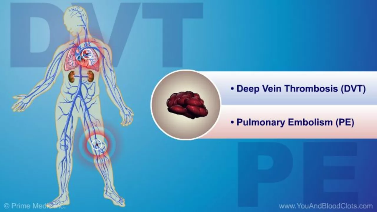 The Connection Between Embolism and Diabetes